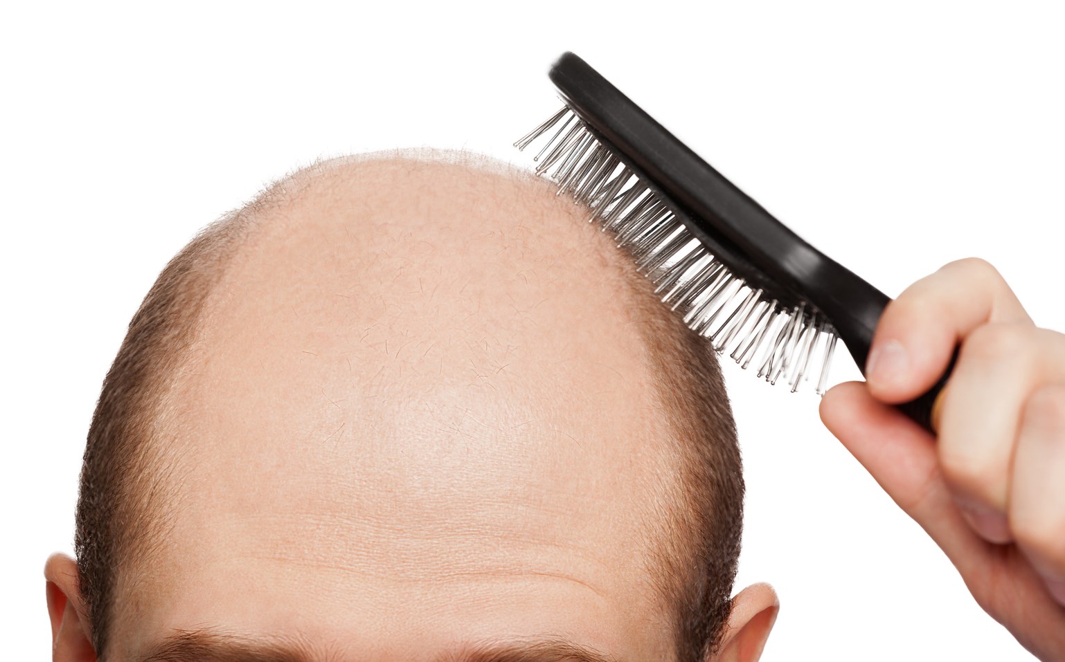 купить шампунь против выпадения волос