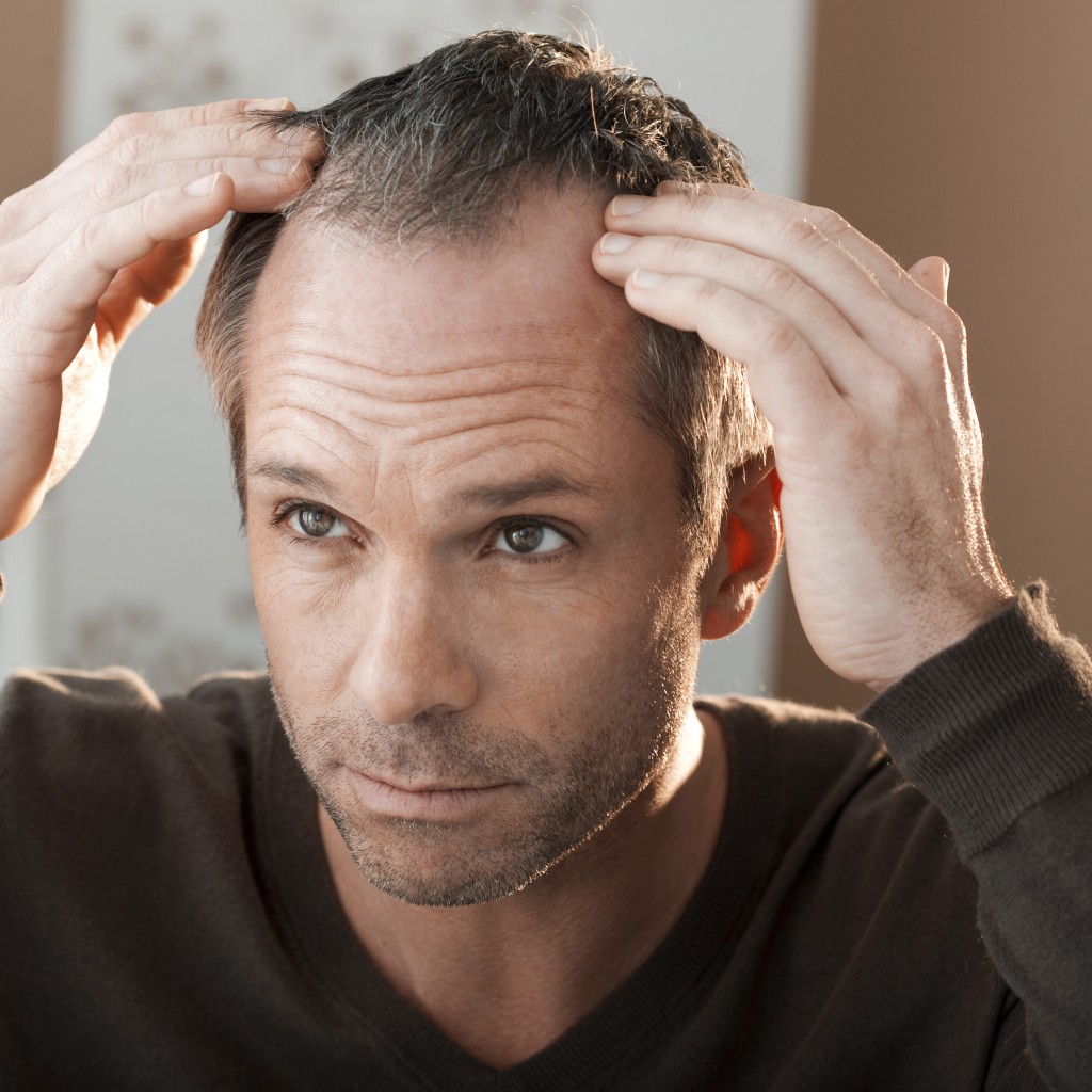 средство от выпадения волос у мужчин